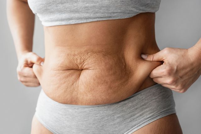 Side Effects of Loose Skin