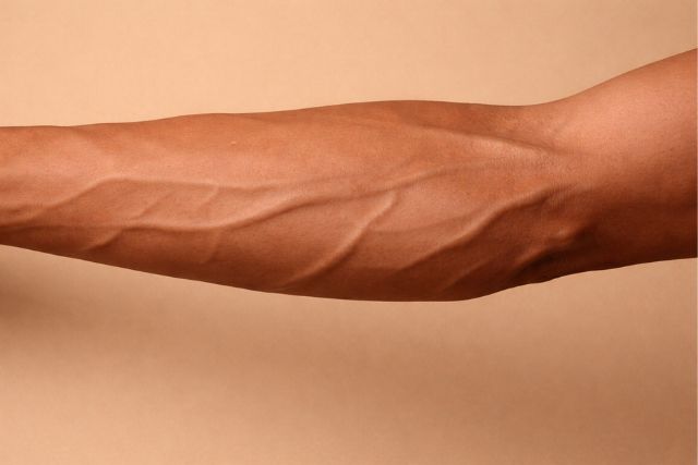 what causes veins to pop out in arms and hands​