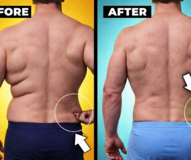 how to get rid of back fat​