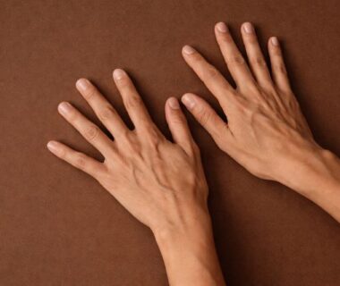 what causes veins to pop out in arms and hands​