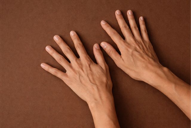 what causes veins to pop out in arms and hands​